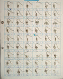 auricular needle